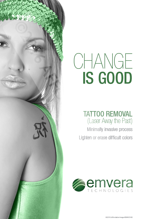 How Long Does It Take To Remove A Tattoo? | Removery