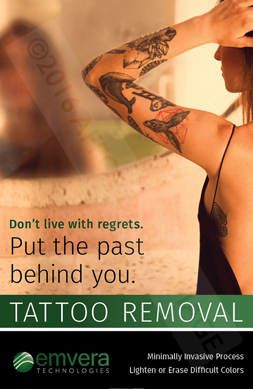 9 Tips for Effective Tattoo Removal Healing - Better Off